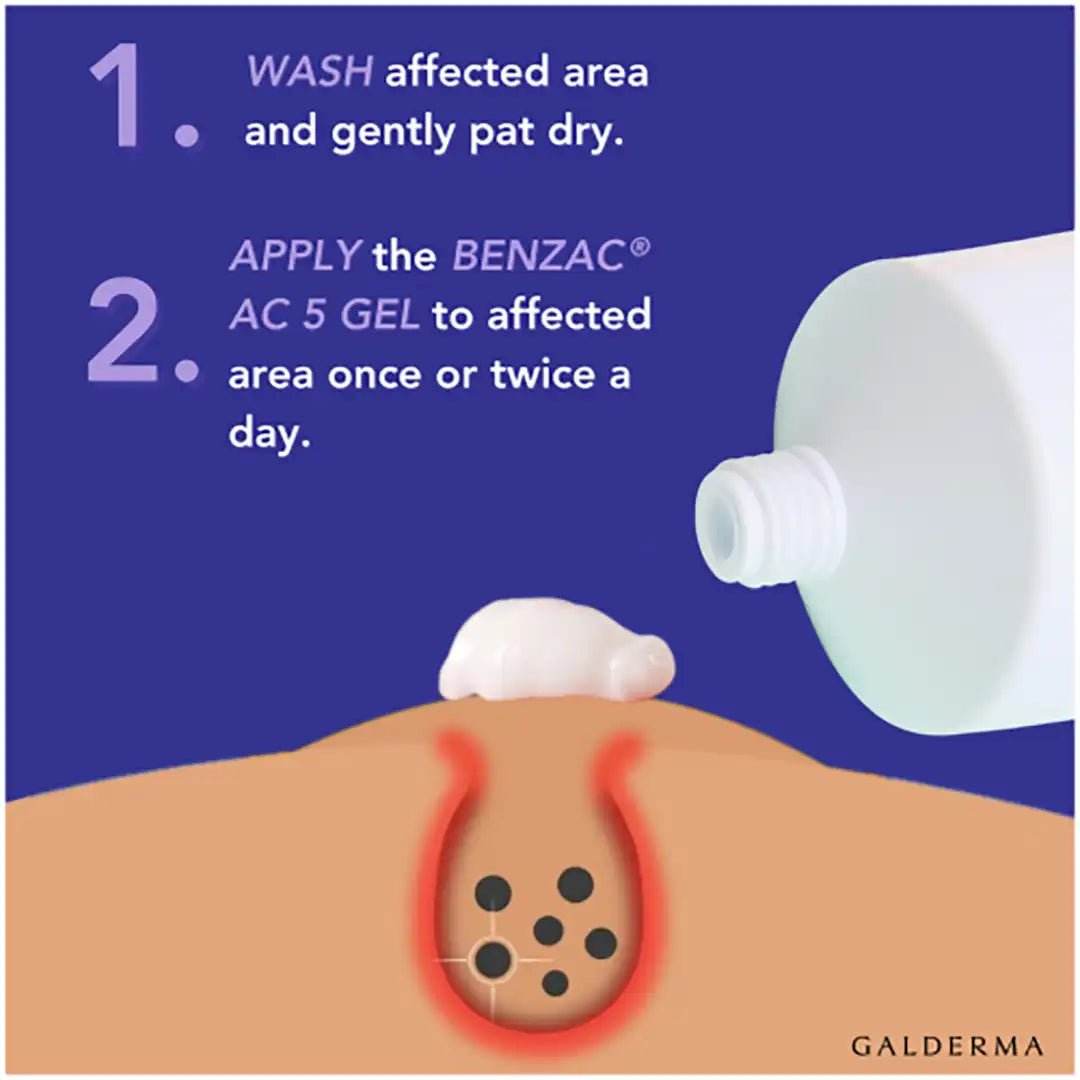 Benzac AC 5 Gel, 15g - Vaids PharmacyBenzac AC 5 Gel, 15gGaldermaVaids Pharmacy807842029